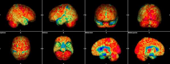 Neurologie